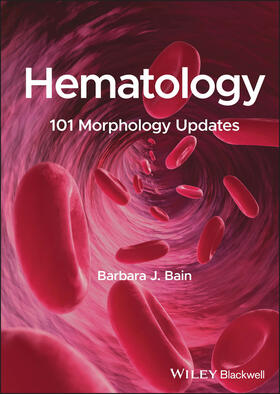 Bain |  Hematology | Buch |  Sack Fachmedien