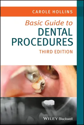 Hollins |  Basic Guide to Dental Procedures | Buch |  Sack Fachmedien