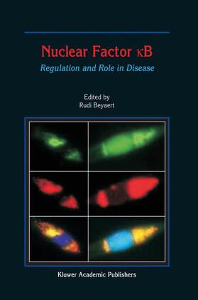 Beyaert |  Nuclear Factor &#1082;b | Buch |  Sack Fachmedien