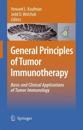 Wolchok / Kaufman |  General Principles of Tumor Immunotherapy | Buch |  Sack Fachmedien