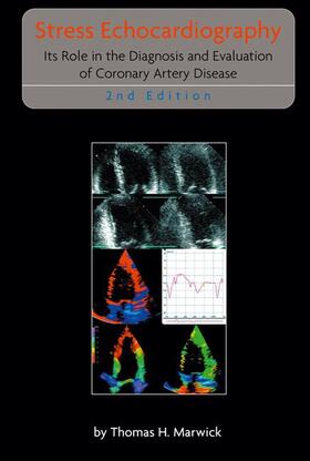 Marwick |  Stress Echocardiography | Buch |  Sack Fachmedien