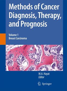 Hayat |  Methods of Cancer Diagnosis, Therapy and Prognosis | Buch |  Sack Fachmedien