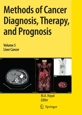 Hayat |  Methods of Cancer Diagnosis, Therapy, and Prognosis | eBook | Sack Fachmedien