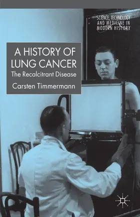 Timmermann |  A History of Lung Cancer | Buch |  Sack Fachmedien