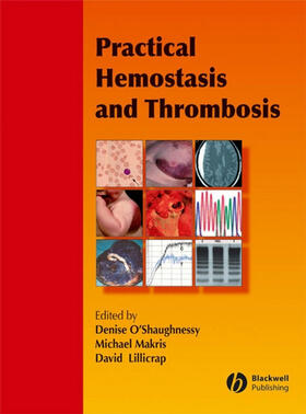 O'Shaughnessy / Makris / Lillicrap |  Practical Hemostasis and Thrombosis | Buch |  Sack Fachmedien