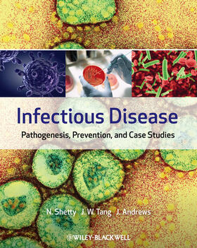 Shetty / W Tang / Andrews |  Infectious Disease | Buch |  Sack Fachmedien