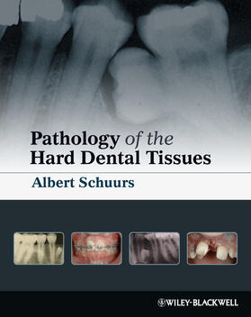 Schuurs |  Pathology of the Hard Dental T | Buch |  Sack Fachmedien