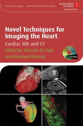 Di Carli / Kwong |  Novel Techniques for Imaging the Heart | Buch |  Sack Fachmedien