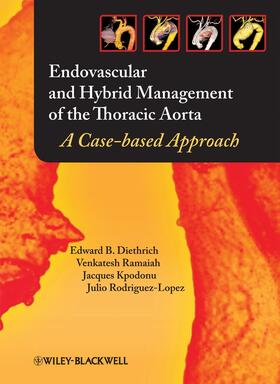 Diethrich / Ramaiah / Kpodonu |  Endovascular and Hybrid Management of the Thoracic Aorta | Buch |  Sack Fachmedien