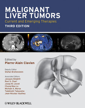 Clavien / Breitenstein / Belghiti |  Malignant Liver Tumors | Buch |  Sack Fachmedien