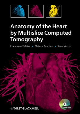 Faletra / Pandian / Ho |  Anatomy of the Heart by Multislice Computed Tomography | Buch |  Sack Fachmedien