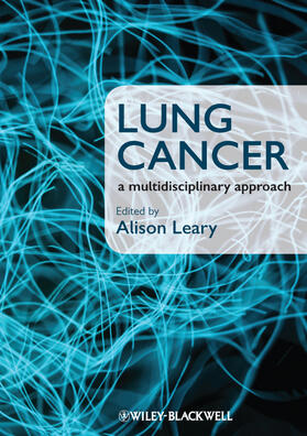 Leary |  Lung Cancer | Buch |  Sack Fachmedien