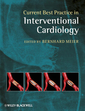 Meier |  Current Best Practice in Interventional Cardiology | Buch |  Sack Fachmedien