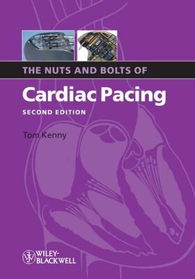 Kenny |  Nuts Bolts Cardiac Pacing 2e | Buch |  Sack Fachmedien