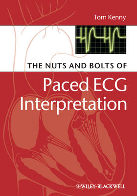 Kenny |  The Nuts and Bolts of Paced ECG Interpretation | Buch |  Sack Fachmedien