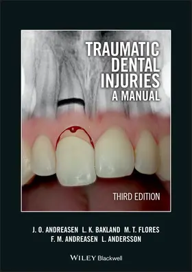 Andreasen / Bakland / Flores |  Traumatic Dental Injuries | Buch |  Sack Fachmedien