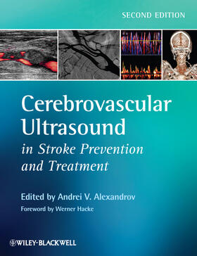 Alexandrov |  Cerebrovascular Ultrasound in Stroke Prevention and Treatment | Buch |  Sack Fachmedien