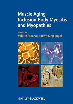 Askanas / Engel |  Muscle Aging, Inclusion-Body Myositis and Myopathies | Buch |  Sack Fachmedien