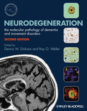 Dickson / Weller |  Neurodegeneration | Buch |  Sack Fachmedien