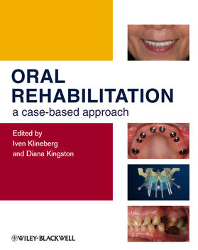 Klineberg / Kingston |  Oral Rehabilitation | Buch |  Sack Fachmedien
