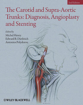 Henry / Diethrich / Polydorou |  The Carotid and Supra-Aortic Trunks | Buch |  Sack Fachmedien