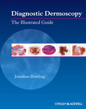 Bowling |  Diagnostic Dermoscopy | Buch |  Sack Fachmedien