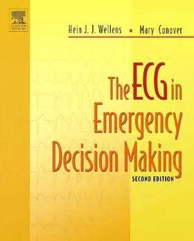 Wellens / Conover |  The ECG in Emergency Decision Making | Buch |  Sack Fachmedien