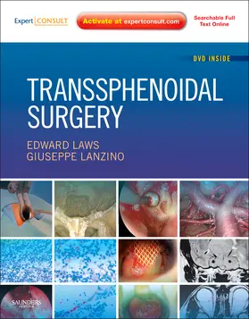 Laws Jr / Lanzino |  Transsphenoidal Surgery | Buch |  Sack Fachmedien