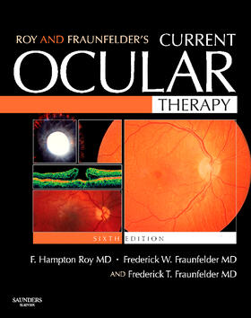 Roy / Fraunfelder | Roy and Fraunfelder's Current Ocular Therapy | Buch | 978-1-4160-2447-7 | sack.de