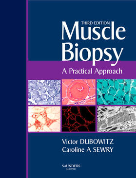 Dubowitz / Sewry |  Muscle Biopsy | Buch |  Sack Fachmedien