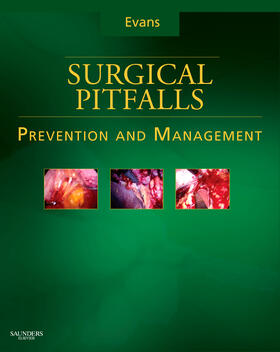 Evans |  Surgical Pitfalls: Prevention and Management | Buch |  Sack Fachmedien