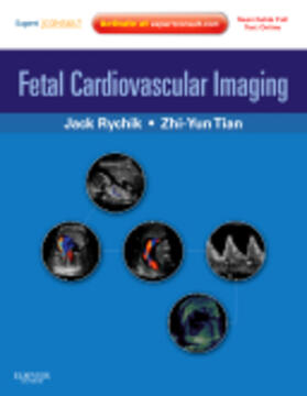 Rychik / Tian |  Fetal Cardiovascular Imaging | Buch |  Sack Fachmedien
