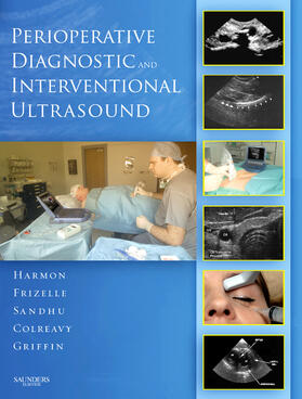 Harmon / Frizelle / Sandhu | Perioperative Diagnostic and Interventional Ultrasound with DVD | Buch | 978-1-4160-3356-1 | sack.de