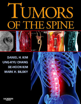 Kim / Chang / Bilsky | Tumors of the Spine | Buch | 978-1-4160-3367-7 | sack.de