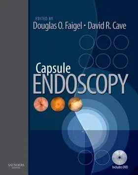 Faigel / Cave |  Capsule Endoscopy | Buch |  Sack Fachmedien