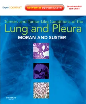 Moran / Suster |  Tumors and Tumor-like Conditions of the Lung and Pleura | Buch |  Sack Fachmedien