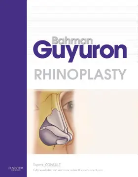 Guyuron |  Rhinoplasty | Buch |  Sack Fachmedien