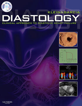Klein / Garcia | Diastology | Buch | 978-1-4160-3754-5 | sack.de