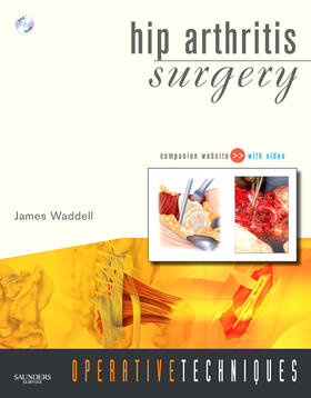 Waddell | Operative Techniques: Hip Arthritis Surgery | Buch | 978-1-4160-3850-4 | sack.de