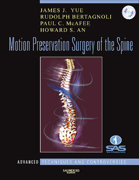 Yue / Bertagnoli / McAfee | Motion Preservation Surgery of the Spine | Buch | 978-1-4160-3994-5 | sack.de
