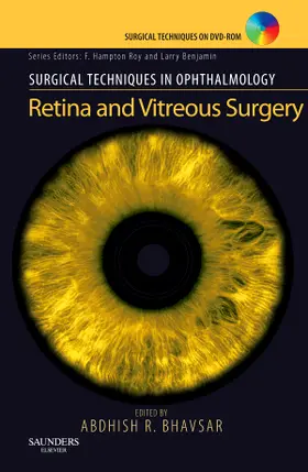 Bhavsar |  Retina and Vitreous Surgery | Buch |  Sack Fachmedien