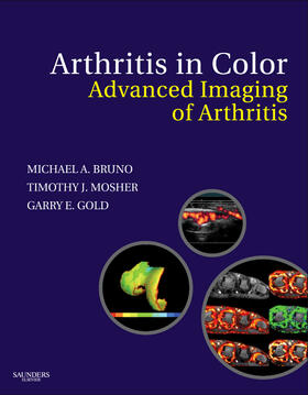 Bruno / Gold / Mosher | Arthritis in Color | Buch | 978-1-4160-4722-3 | sack.de