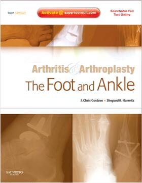 Coetzee / Hurwitz |  Arthritis and Arthroplasty: The Foot and Ankle | Buch |  Sack Fachmedien