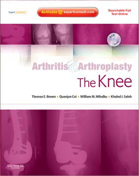 Brown / Cui / Mihalko | The Knee | Buch | 978-1-4160-4974-6 | sack.de