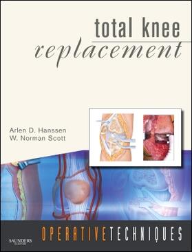 Hanssen / Scott | Operative Techniques: Total Knee Replacement | Buch | 978-1-4160-4984-5 | sack.de