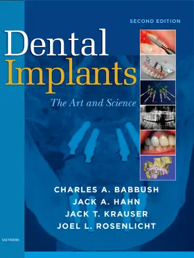 Babbush / Hahn / Krauser |  Dental Implants | Buch |  Sack Fachmedien