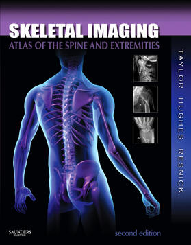 Taylor / Hughes / Resnick |  Skeletal Imaging | Buch |  Sack Fachmedien