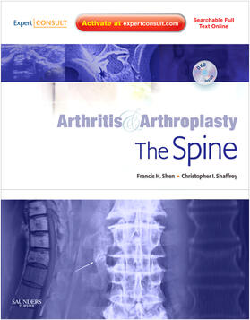 Shen / Shaffrey |  Arthritis and Arthroplasty: The Spine | Buch |  Sack Fachmedien