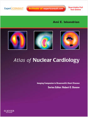 Iskandrian / Garcia / Cerqueira |  Atlas of Nuclear Cardiology | Medienkombination |  Sack Fachmedien