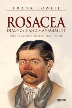 Powell |  Rosacea | Buch |  Sack Fachmedien